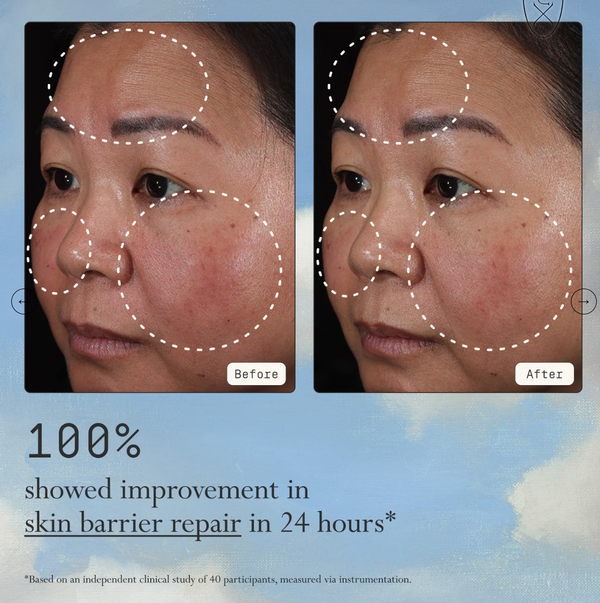 Barrier Restoring & Soothing Daily Moisturizer
